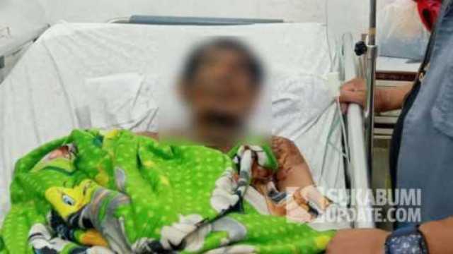 Yana, Tukang Gorengan yang Masuk Wajan Minyak Panas di Sukabumi, Meninggal