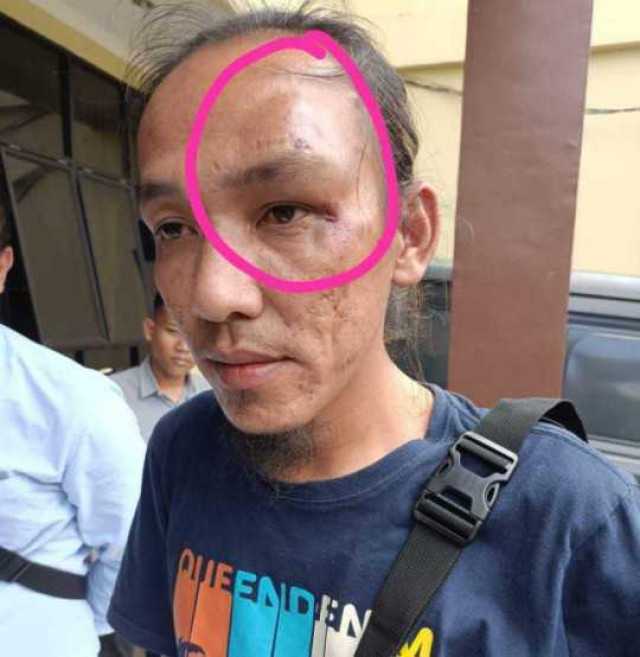 Anggota PWI Lubuk Linggau Babak Belur Dihajar Orang Berseragam Diduga Anggota Brimob. 