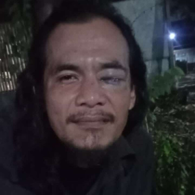 Jurnalis Dikeroyok Saat Liputan Dugaan Makanan Kedaluwarsa di Bekasi