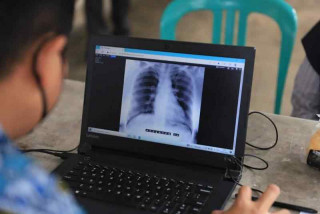  dr. Harmayani: "Kasus TBC Tahun 2022 sekitar 9 ribuan dan 700 kasus di antaranya adalah Anak-anak