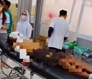 Peringatan Hari Koperasi di Klungkung bawa bencana, balon meledak akibatkan 11 orang luka bakar