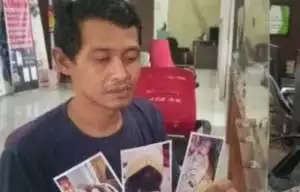Kasus Perawat Gunting Jari Bayi di RS Palembang Diselidiki Polisi