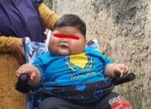 Dinas Kesehatan Catat 20.000 Warga Kota Tangerang Obesitas