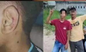 Gelar Perkara Penganiayaan Anak, 3 Terlapor 1 Tersangka